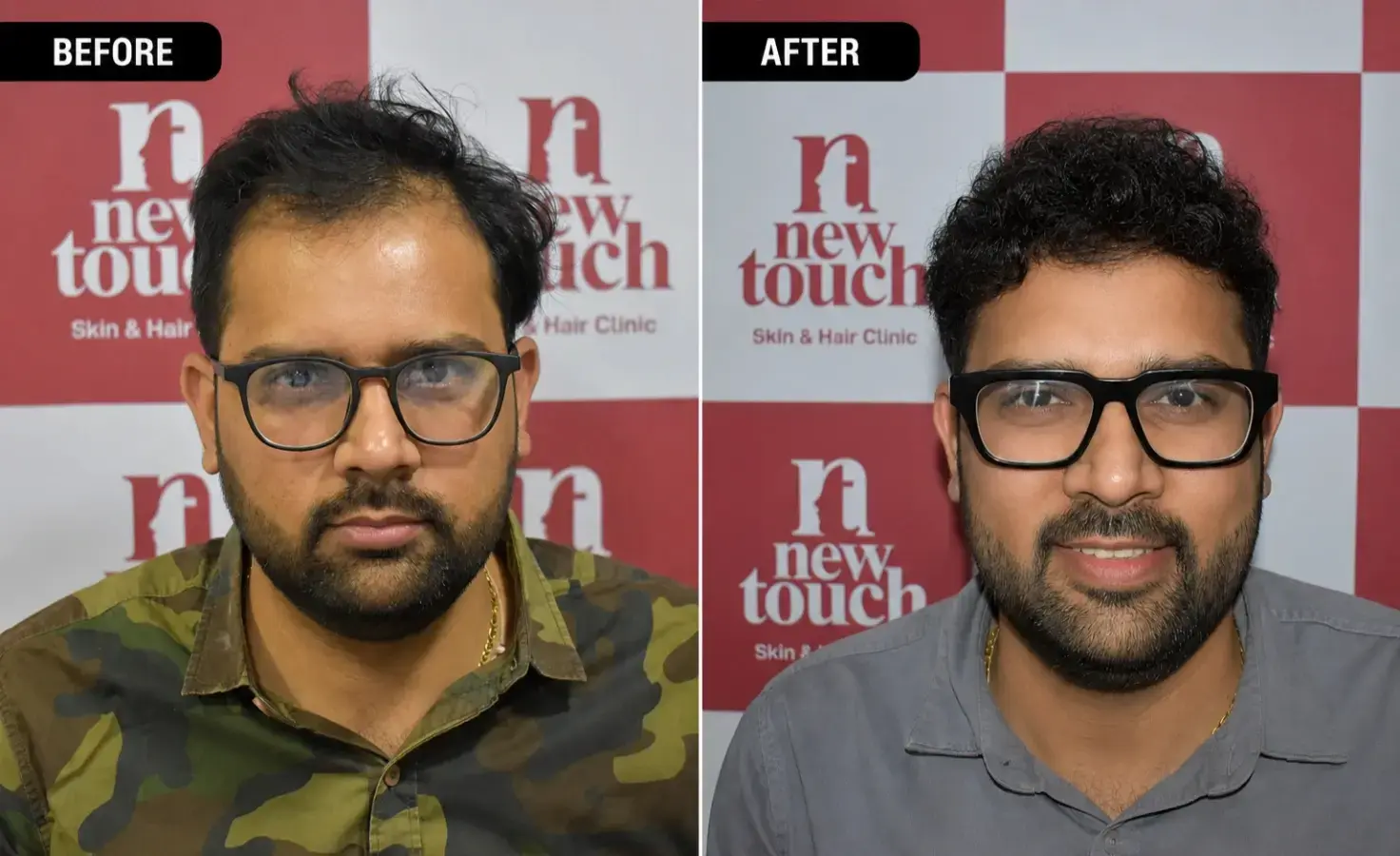 Before and after treatment