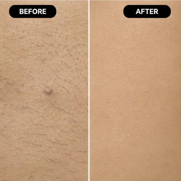 Treatment Results