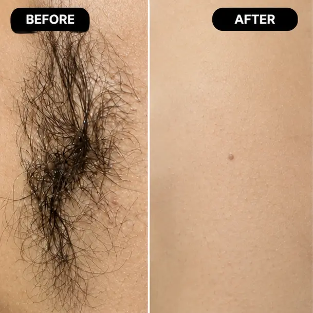Treatment Results