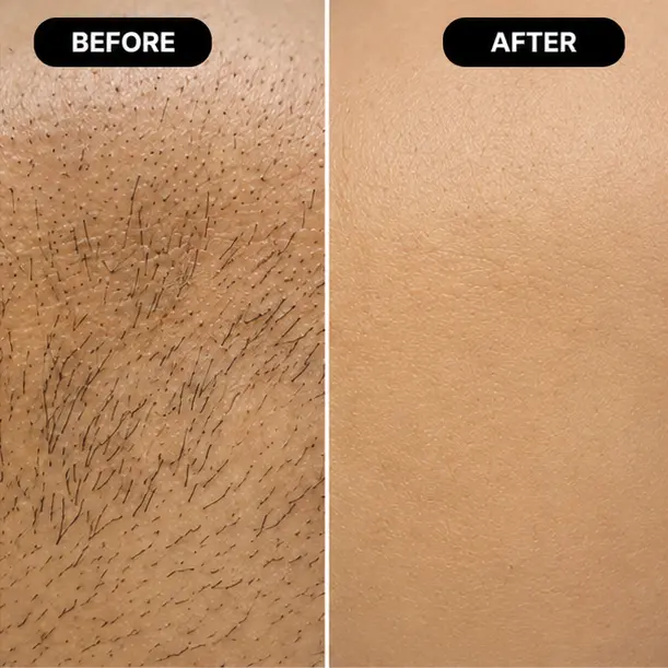 Treatment Results