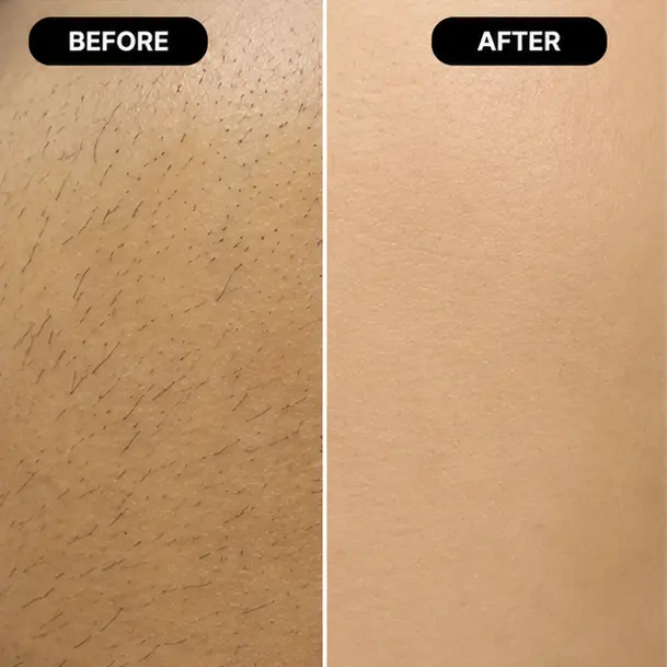 Treatment Results