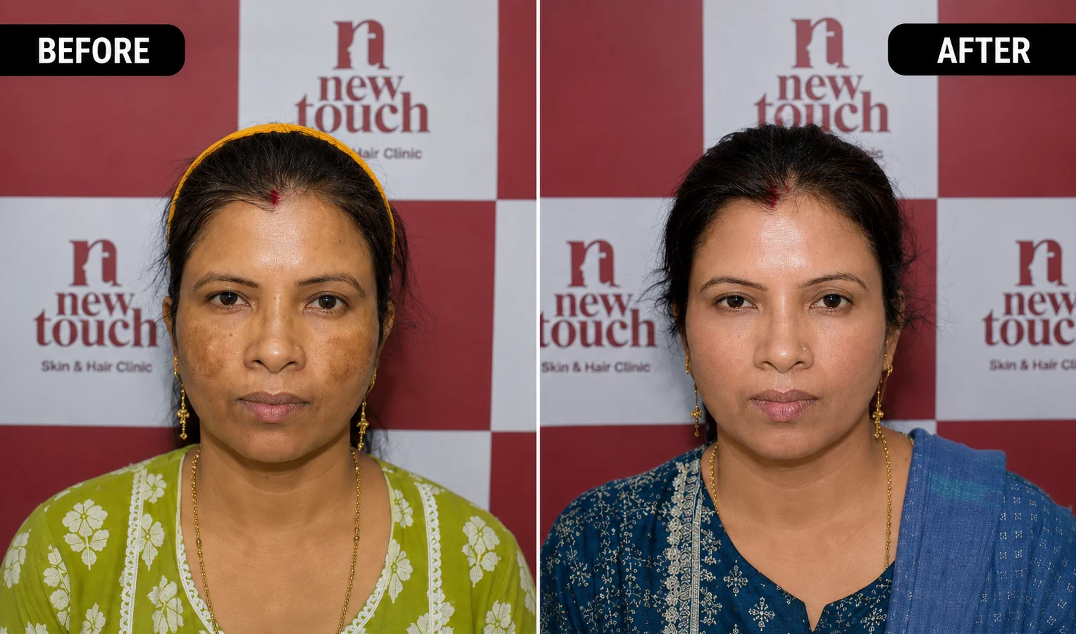 Before and after treatment