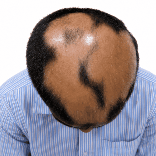 Treatment Results