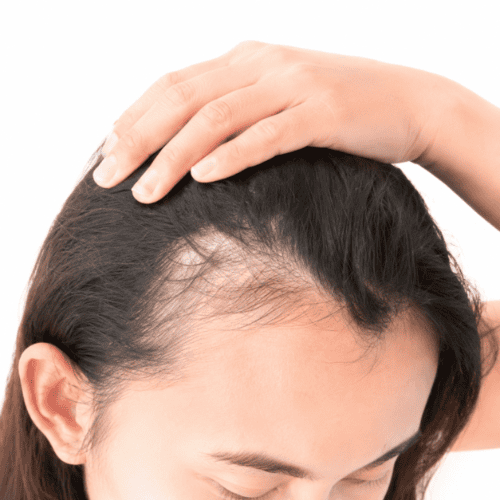 Treatment Results
